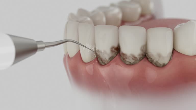 Reliable Dental contractor in Baraga, MI by Smile Center Dentistry